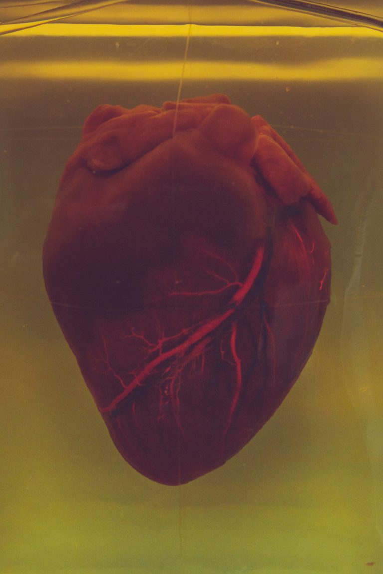 a human heart