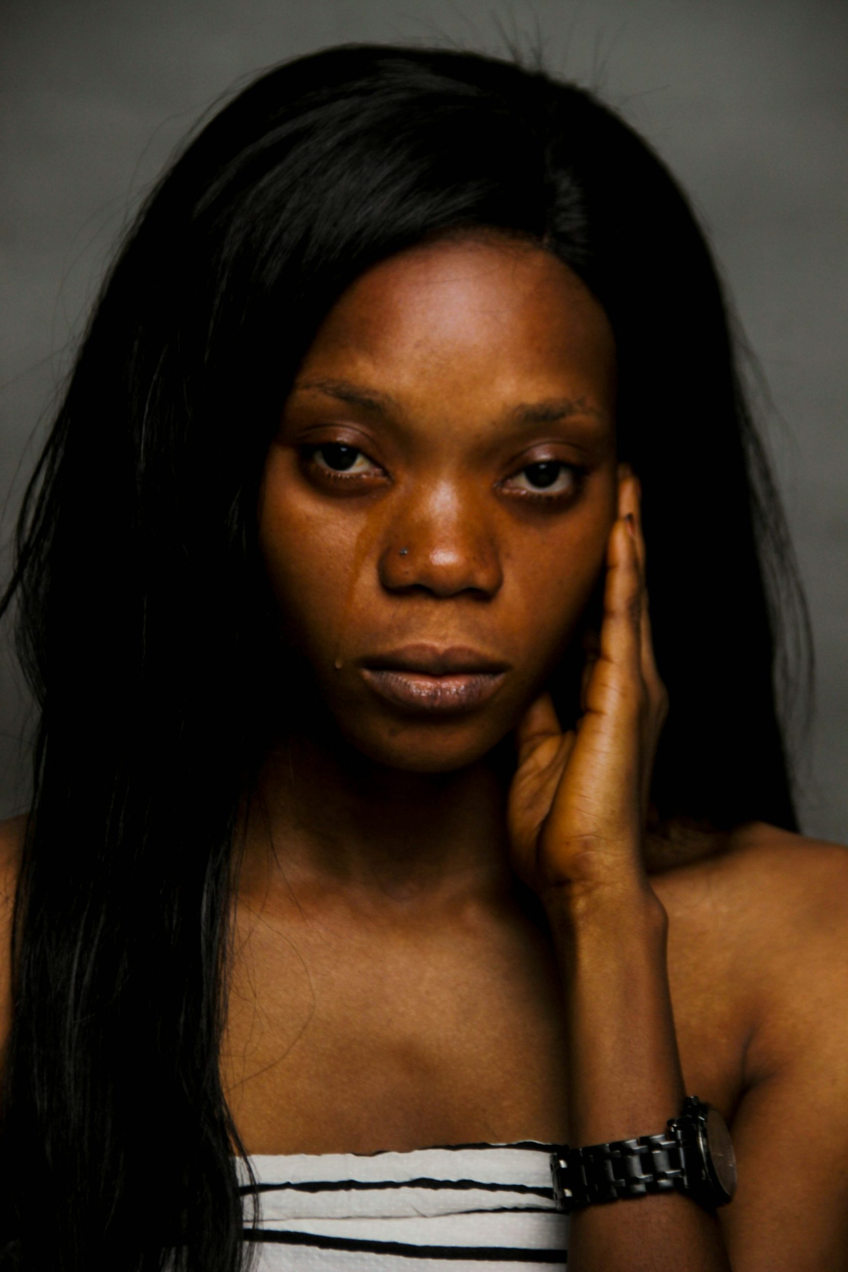 Hiv and aids