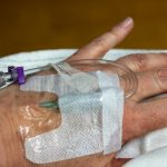 How Does Lupus Affect the Skin, Joints, and Organs?