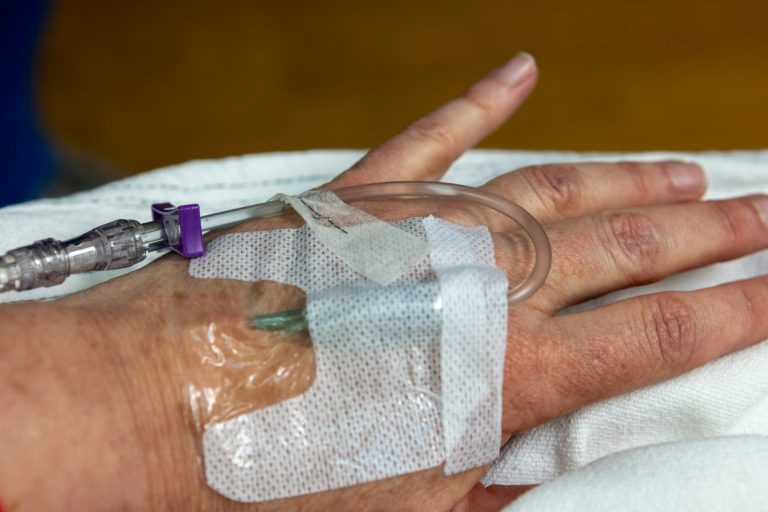 a lupus patient