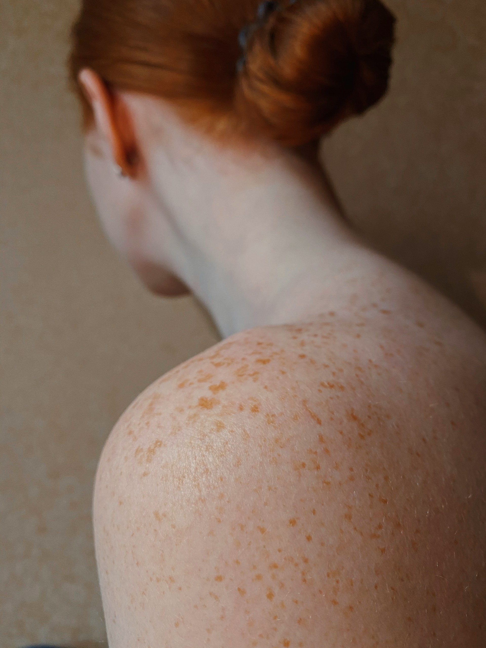 a woman with Skin problem