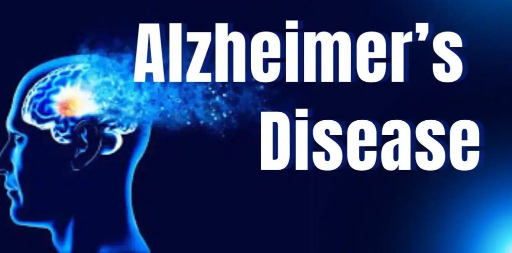 Alzheimer’s Disease: Early Signs You Shouldn’t Ignore, Causes, and Treatments