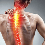 Back Pain: Stretches, Remedies, and When to See a Doctor