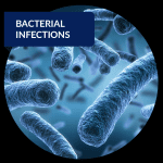 Understanding Bacterial Infections: Prevention and Treatment