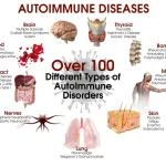 Autoimmune Disorders: Recognizing the Signs, Diagnosis, and Treatment
