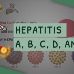 Hepatitis A, B & C: Causes, Symptoms, Transmission & Treatment