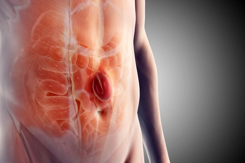 Hernia: Types, Causes, Symptoms & Treatment Options