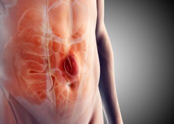 Hernia: Types, Causes, Symptoms & Treatment Options