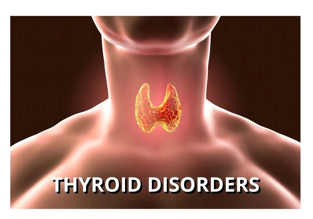 Thyroid Disorders: Symptoms, Causes, Diagnosis & Treatment Options