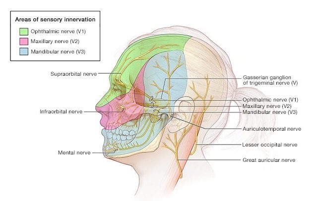 Illustration showing the areas of the face affected by trigeminal neuralgia, one of the most common and painful types.