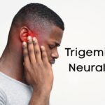 Neuralgia: Symptoms, Causes, Types, and Effective Treatments