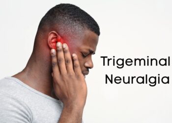 Neuralgia: Symptoms, Causes, Types, and Effective Treatments