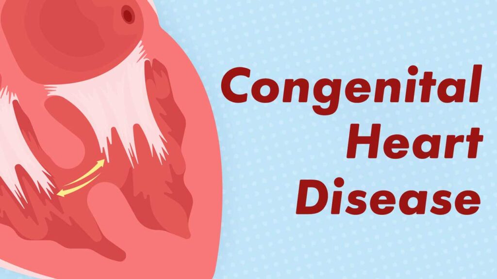 Congenital Heart Disease: Types, Causes, Symptoms & Treatment Options