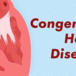 Congenital Heart Disease: Types, Causes, Symptoms & Treatment Options